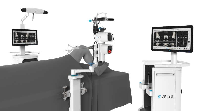VELYS Robotic-Assisted Solution